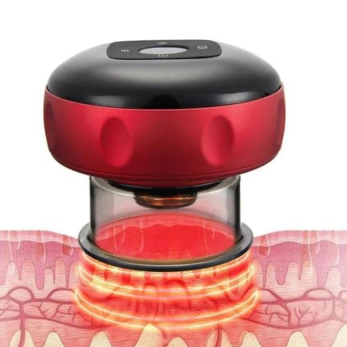 Вакуумний антицелюлітний масажер для тіла 1052 з підігрівом NG 122